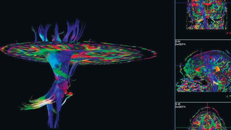 new research in brain mapping