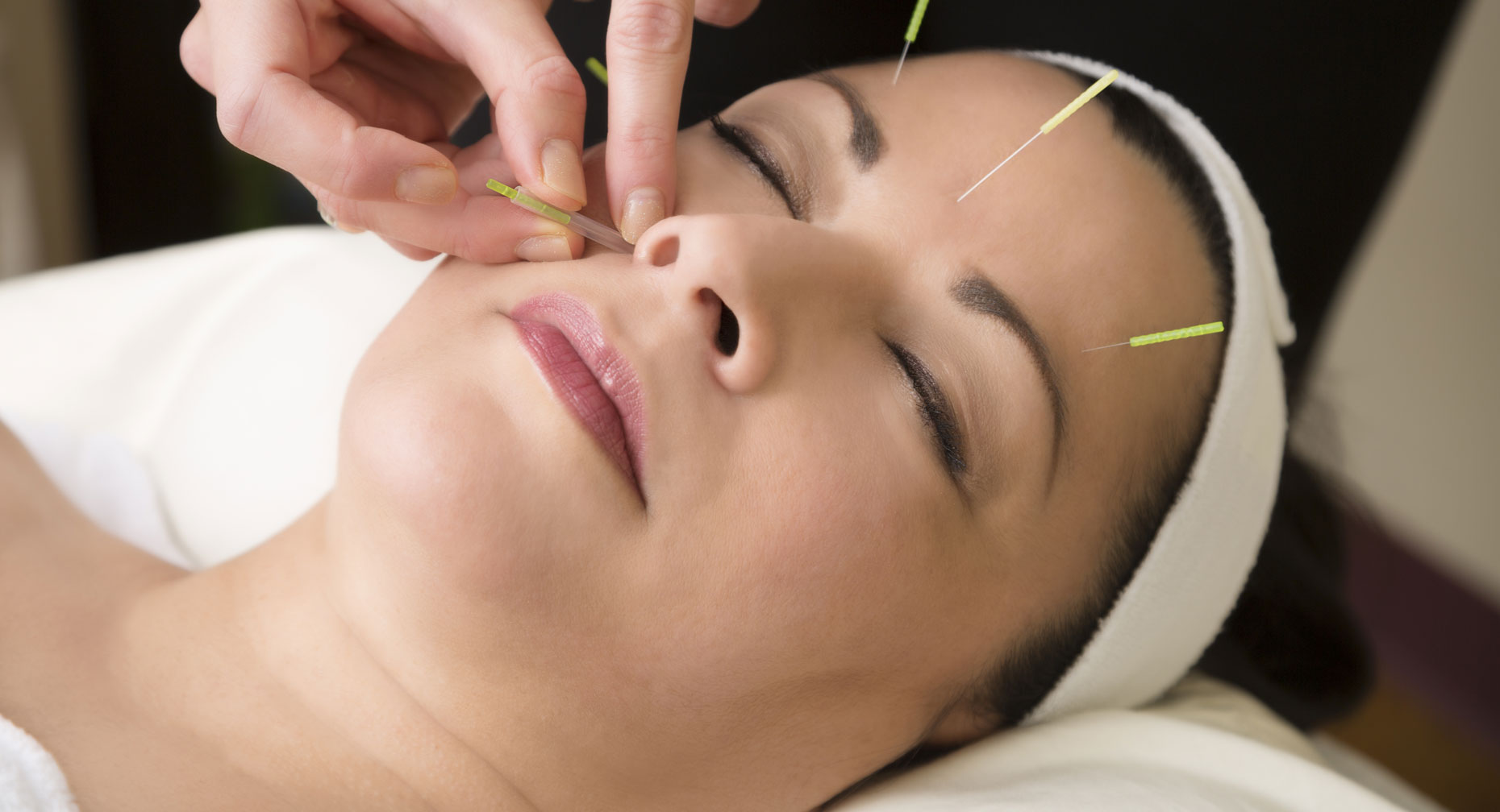 Acupuncture Migraines large